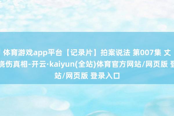 体育游戏app平台【记录片】拍案说法 第007集 丈夫严重烧伤真相-开云·kaiyun(全站)体育官方网站/网页版 登录入口
